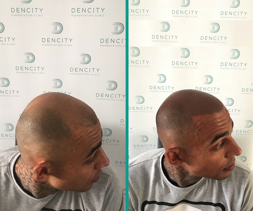 2Client BEFORE AFTER